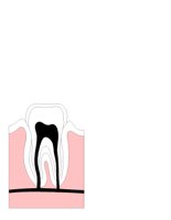 TOOTH.CGM