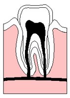 TOOTH.TIF