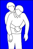 HEIMLICH.WMF