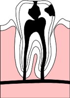 TOOTHDEC.WMF
