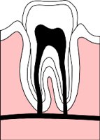 TOOTH.WMF