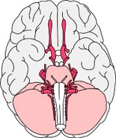 BRAINFUL.WMF