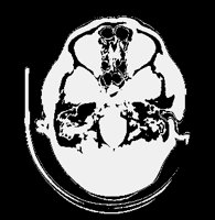 BRAINCATSCAN.IFF