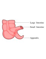 30A003.pct