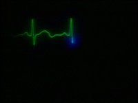 36100.PICT