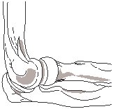 Elbow 1.eps