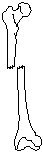 Leg - Transverse Fracture.eps