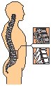 Spinal Column.eps