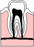 Tooth & Root.eps