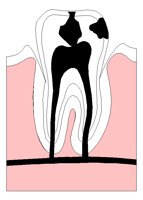 TOOTHDEC.PCX