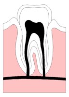TOOTH.PCX