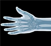XRAYH.WMF