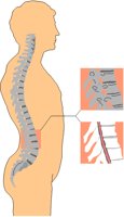 SPINE.PCT