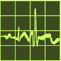 EKG2.PCT