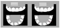 XRAY.PCT