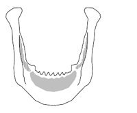 BONE057.WMF