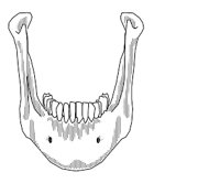 BONE042.WMF