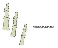 BONE034.WMF