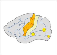 BRAIN2.WMF