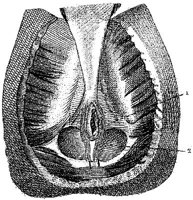 HPN128BH.JPG