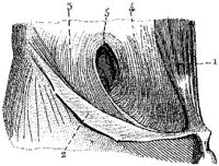 HPN128AS.JPG