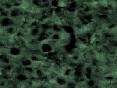 xm006799.gif