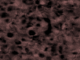 xm006797.gif