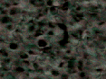 xm006796.gif