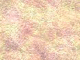 xm006458.gif