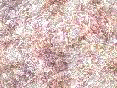 xm006419.gif