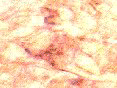 xm006405.gif