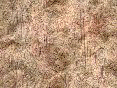 xm006393.gif