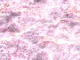 xm006381.gif