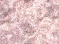 xm006376.gif