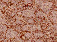 xm007064.gif