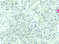 xm007044.gif