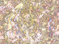 xm007032.gif