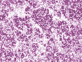 xm007022.gif