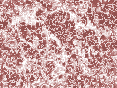 xm007017.gif