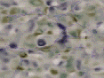 xm007548.gif
