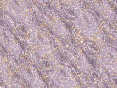 xm007538.gif
