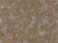 xm007535.gif