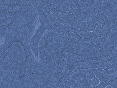 xm007515.gif