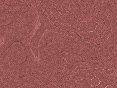 xm007514.gif