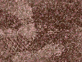 xm007479.gif