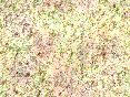 xm007981.gif