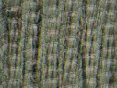 xm007978.gif