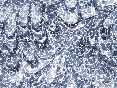 xm008687.gif