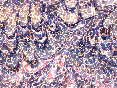 xm008683.gif