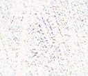 xm008899.gif
